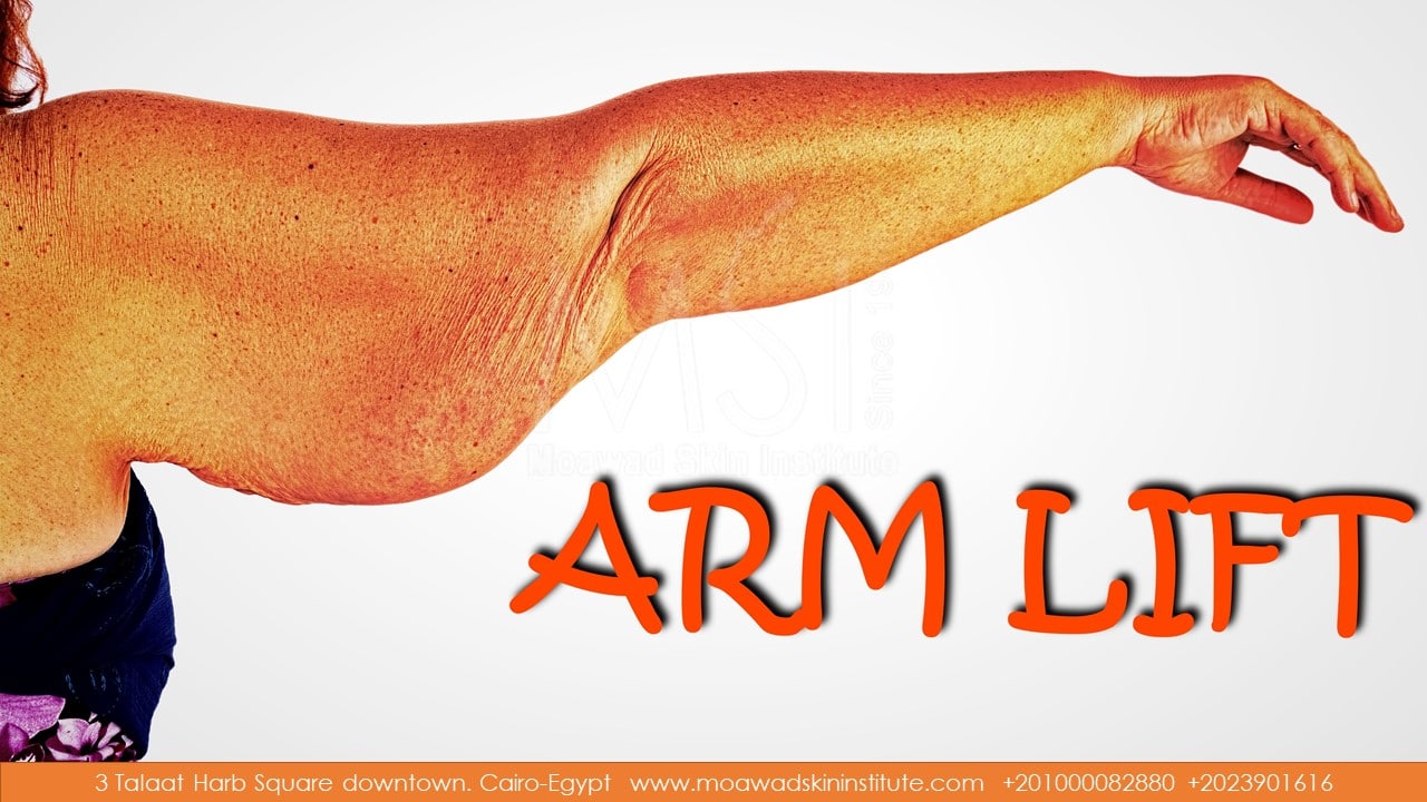 ARM LIFT