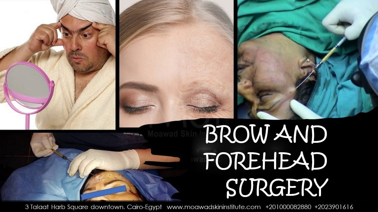 BROW AND FOREHEAD SURGERY