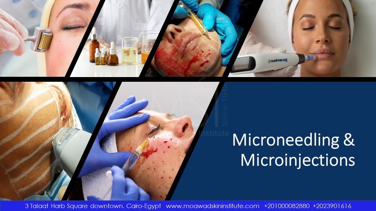 MICRONEEDLING AND MICROINJECTIONS