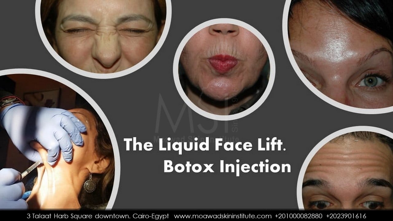 THE LIQUID FACE AND NECK LIFT. BOTOX INJECTION