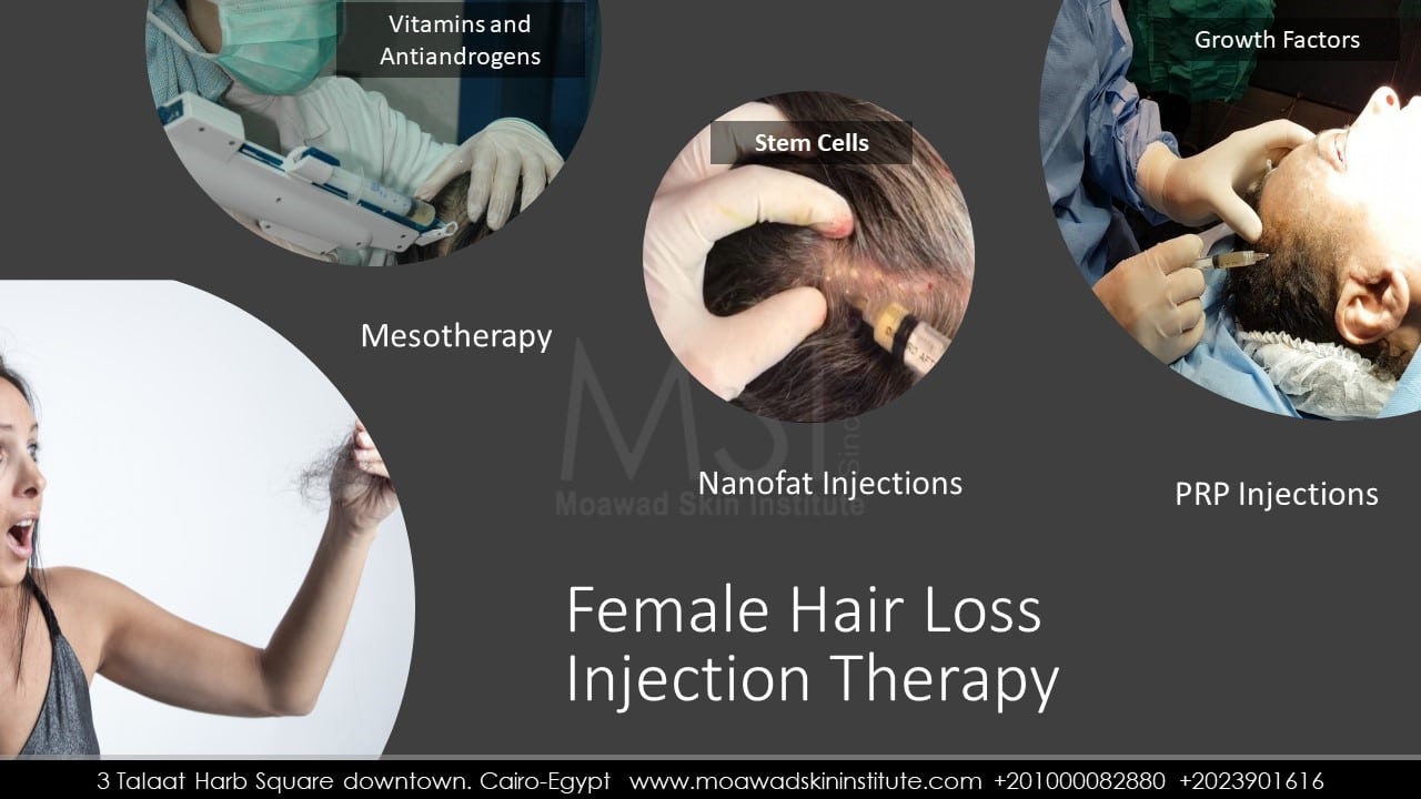 FEMALE HAIR LOSS TREATMENT- INJECTION