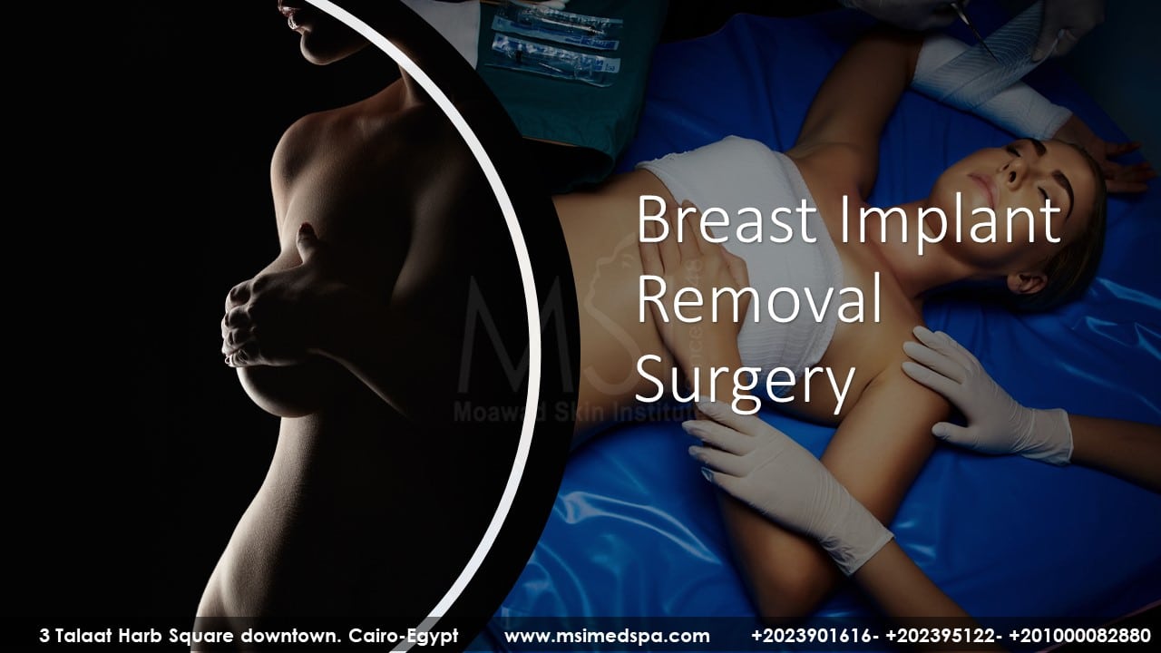 BREAST IMPLANT REMOVAL SURGERY