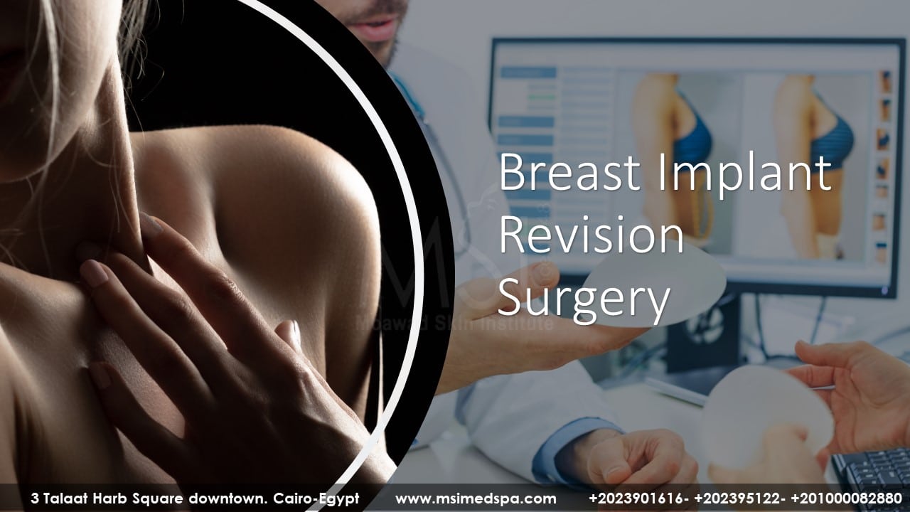 BREAST IMPLANT REVISION SURGERY