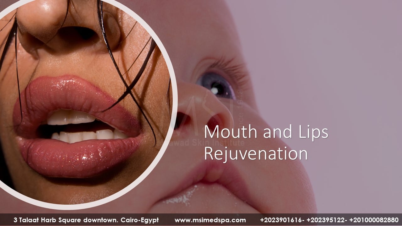 MOUTH AND LIPS REJUVENATION