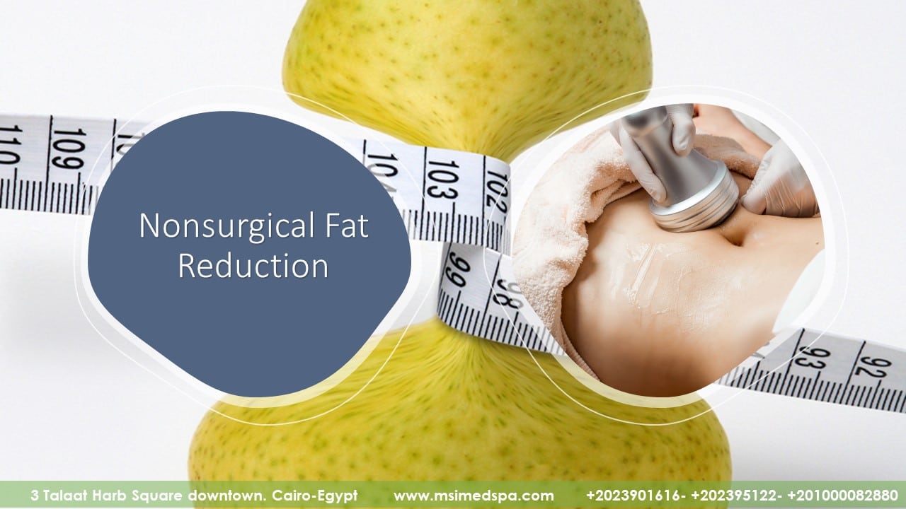 NONSURGICAL FAT REDUCTION